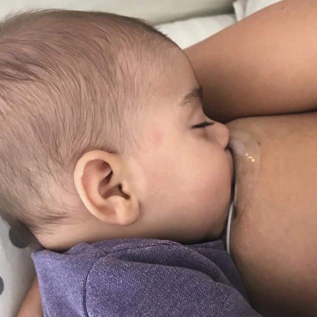 Neotech Bridge® Breastfeeding Assistance Device - Image 3